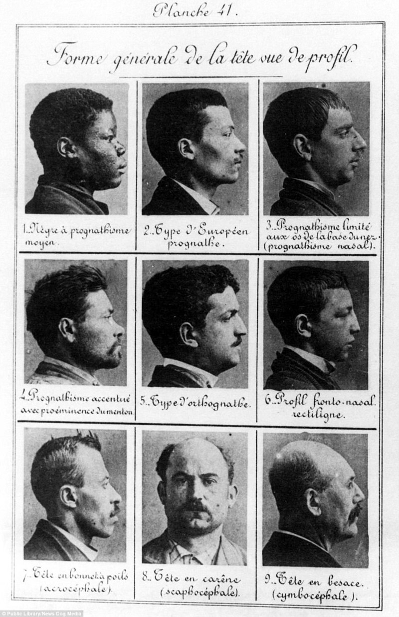 Фотосвидетельства прошлого: как раньше боролись с вырождением человечества