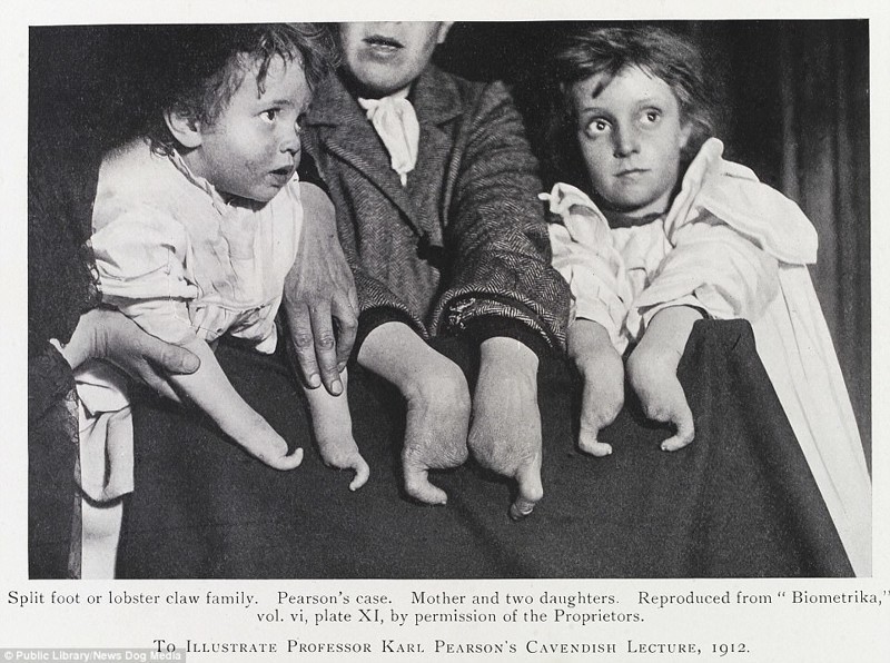 Фотосвидетельства прошлого: как раньше боролись с вырождением человечества