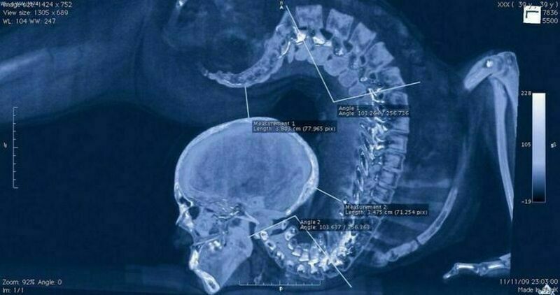 Блог - 13 фото спортсменов, показывающих, на какие невероятные вещи способно наше тело 13 фото спортсменов, показывающих, на какие невероятные вещи способно наше тело