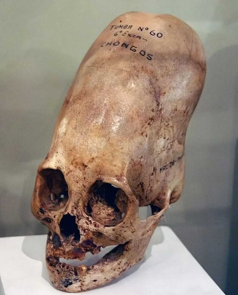 Блог - 15 самых тревожных изображений, которые кажутся сбоем в матрице, но они реальны 15 самых тревожных изображений, которые кажутся сбоем в матрице, но они реальны