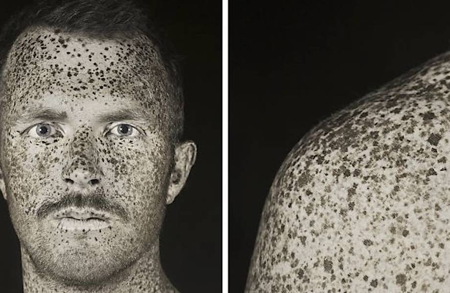 Инженер использует УФ-фотографию, чтобы показать, как солнце влияет на нашу кожу